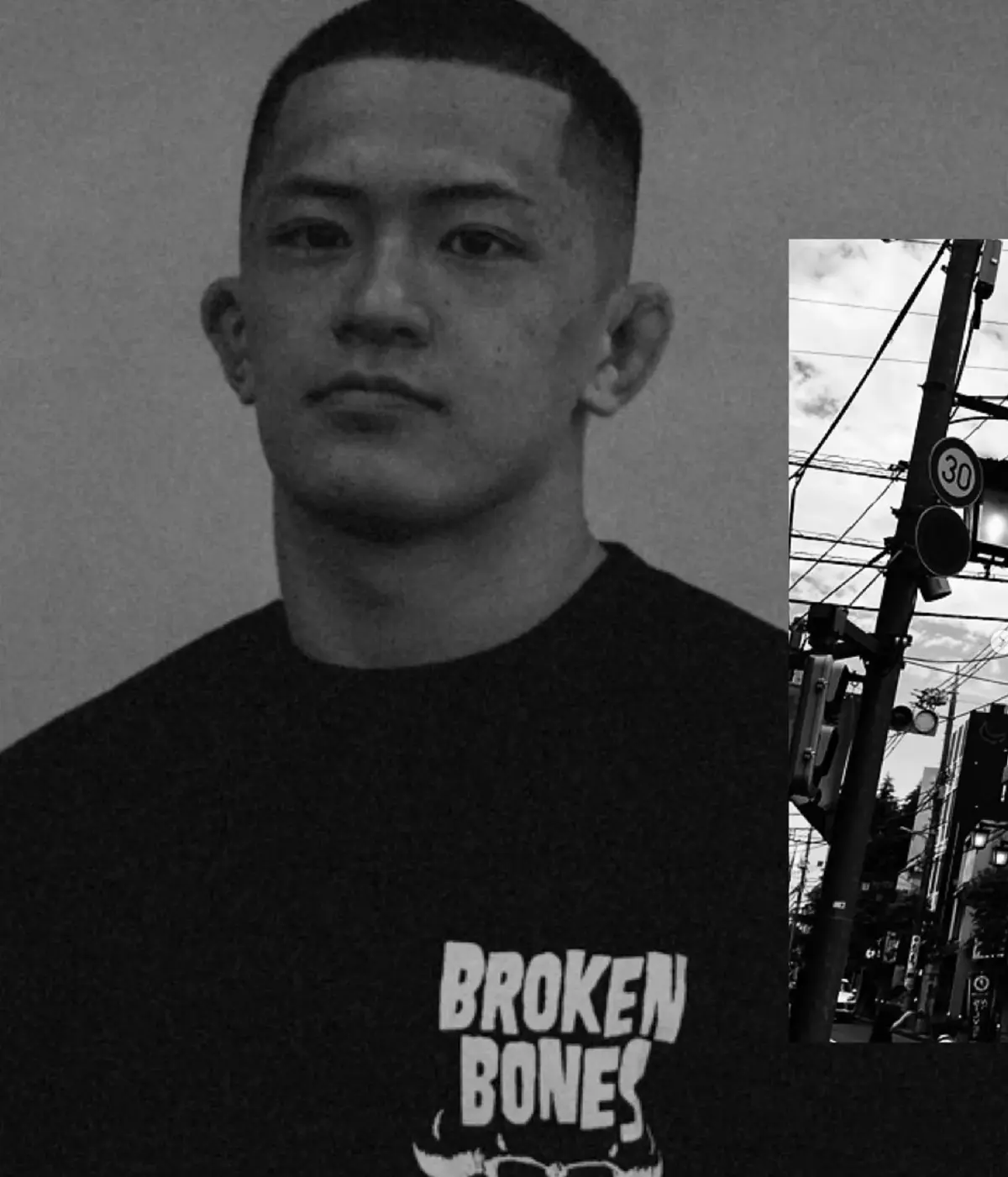 Broken Bones - Image 3